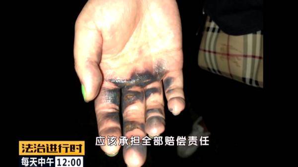 电动车|女子骑“共享电动车”被电伤，索赔遭遇阻力