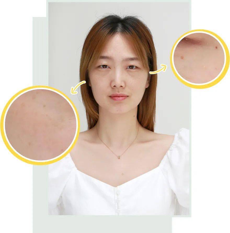 黑色素|广告商特别叮嘱我们，这篇推送的图片不许PS