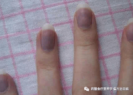 3fd367c364d5444fb1a73aa36a76ea3a.png