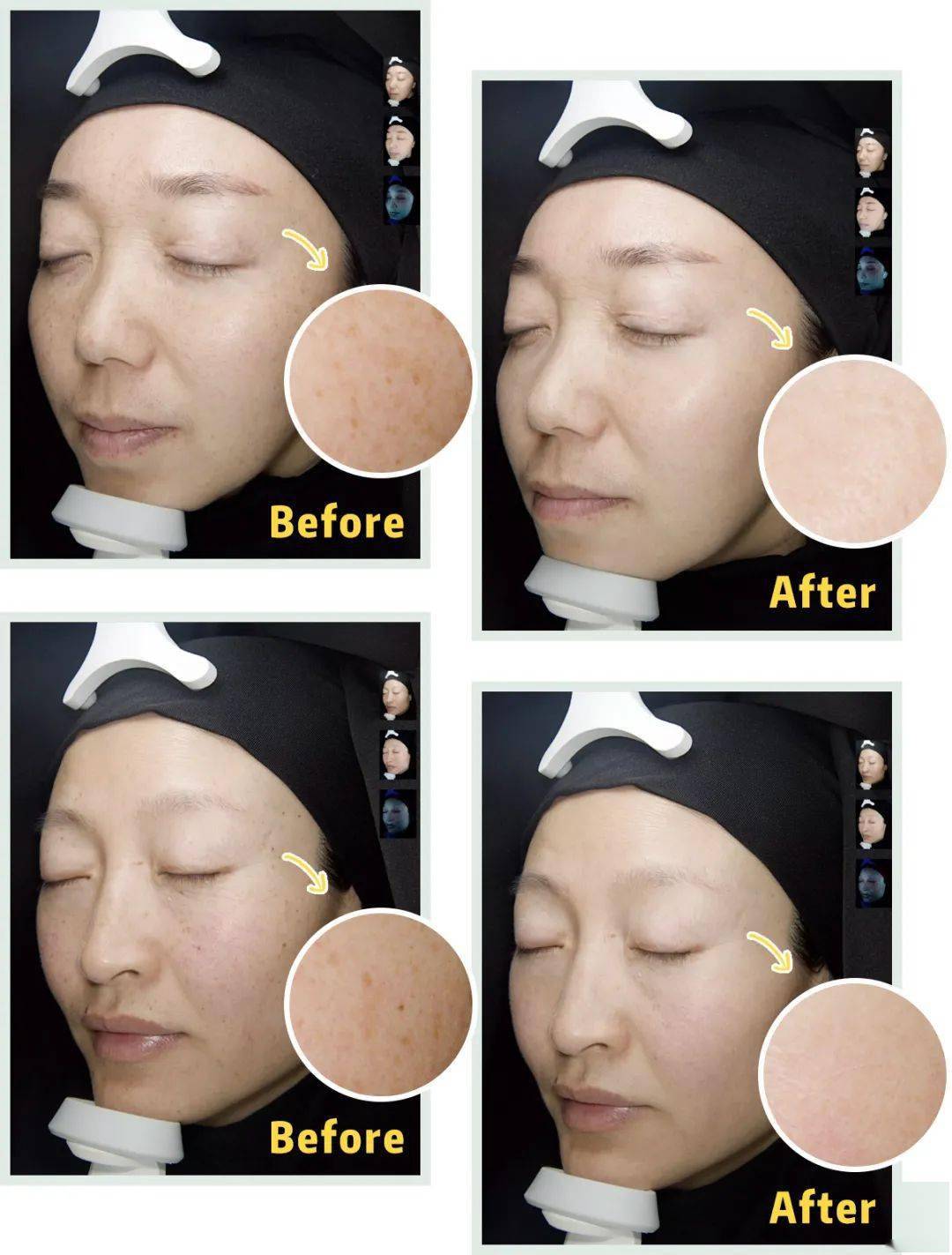 黑色素|广告商特别叮嘱我们，这篇推送的图片不许PS