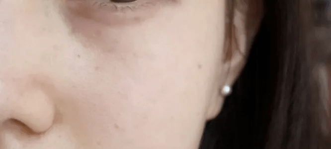 皮肤|用它点一点，痘印、斑点竟然没了，难怪李佳琦都为它疯狂打call！