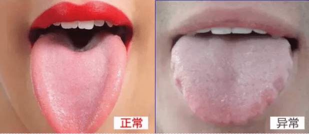 虚胖|拒做“小腹婆”！【超值团购】三伏天体内湿？每天吃点它！远离虚胖、口臭