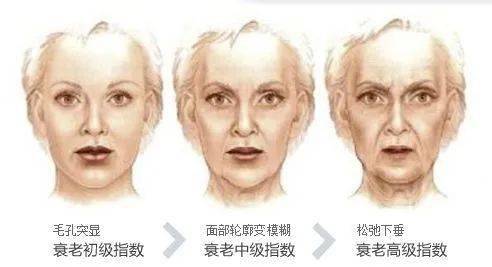 姐姐|乘风破浪的姐姐火了，没想到这些医美项目竟然也火了！