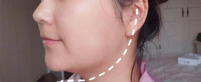 效果|这个比瘦脸针还好用的好物，既消水肿又提拉紧致，立变小V脸！