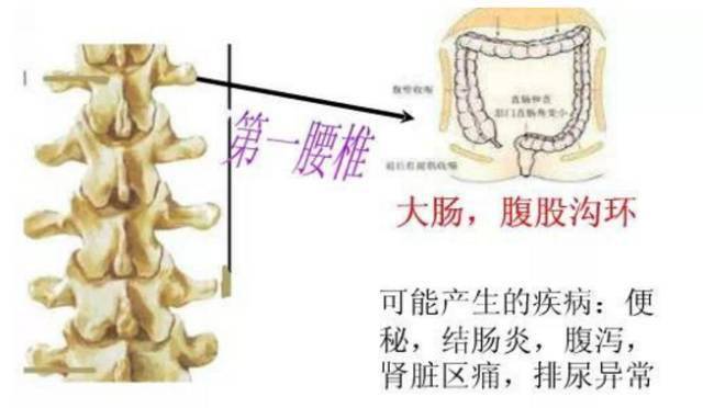 第三椎准确位置 c1674a3e9805477782e91f50f7ccc6b6.jpeg