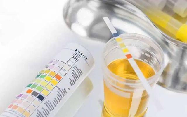 mg|为什么糖尿病患者要检测“尿微量白蛋白”？