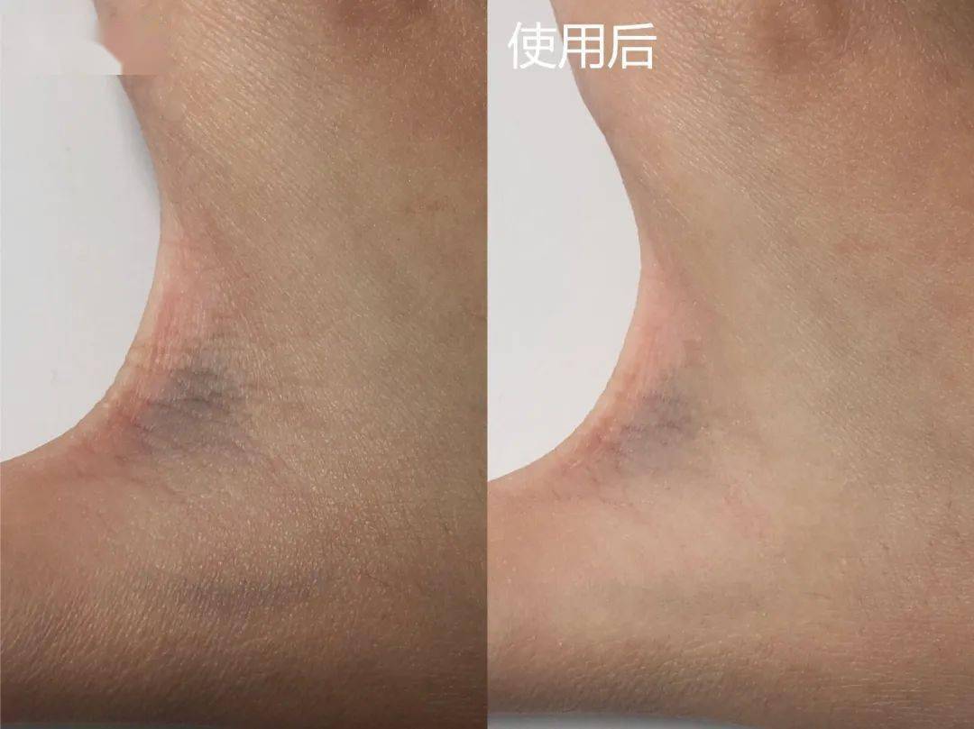 效果|震撼黑科技！搞定眼袋、细纹、浮肿、黑眼圈……效果比PS还好！