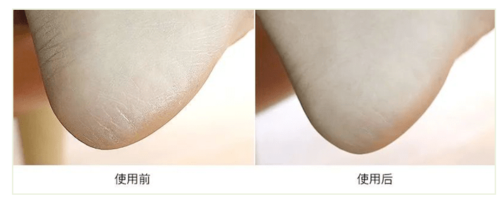 鸡皮|种草+｜美白、纤体、清爽！这5款夏日身体乳，亲测好用