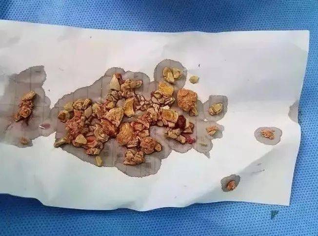 孩子|智商倒退、发育落后！ 这些错误的喂养方式是在害娃。2岁聪明宝宝被亲戚喂白酒
