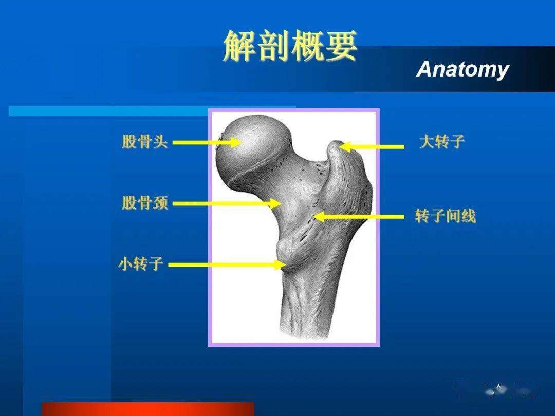 病例28 股骨颈骨折(基底型)-特种医学-医学
