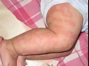 孩子|智商倒退、发育落后！ 这些错误的喂养方式是在害娃。2岁聪明宝宝被亲戚喂白酒