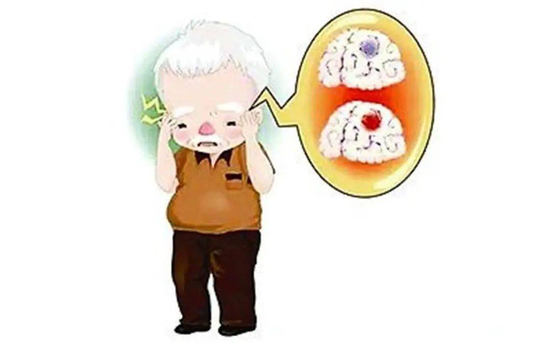 发病|【科普宣传】炎炎夏日，谨防脑卒中“偷袭”