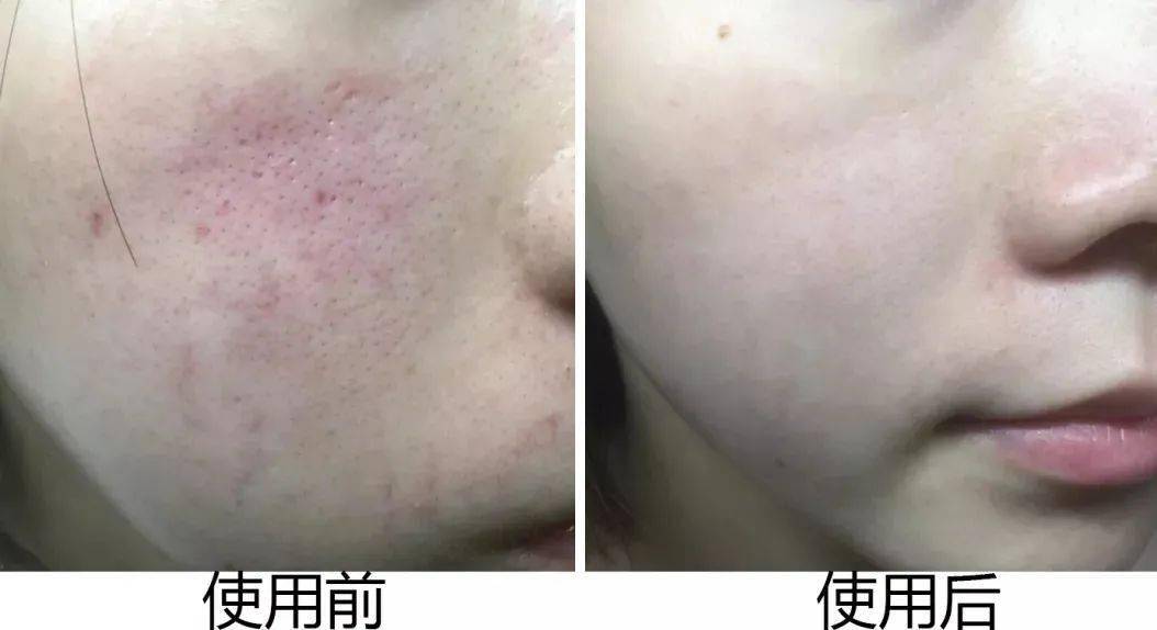 肌肤|30年老国货，别因便宜而嫌弃，一瓶用全身，真正实力派