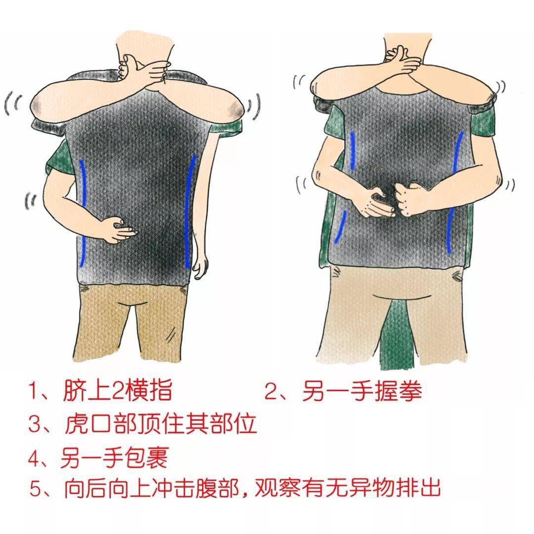 自救|转发可救人一命！多个孩子不幸身亡！护士手绘自救图刷爆朋友圈