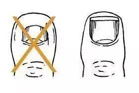 凶手|【警惕】男子险被截肢，凶手竟是一条鱼！只因忽视了这个细节...