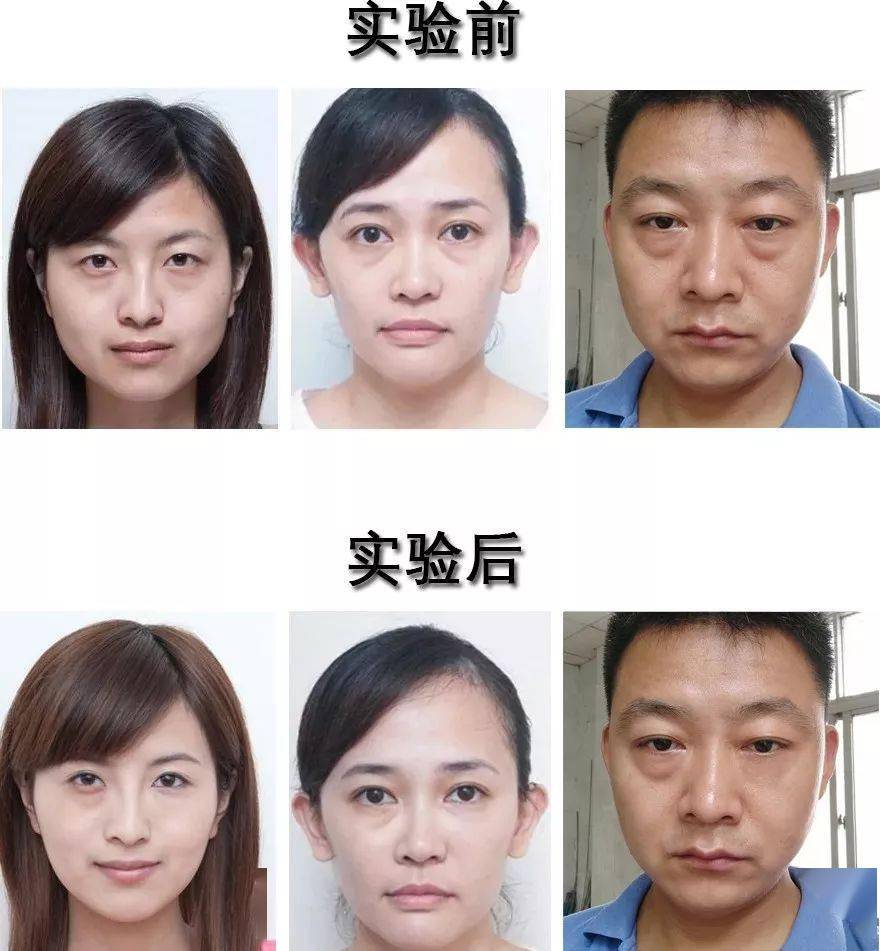 方法|眼袋显老又显丑，教你一方法轻松干掉它！！