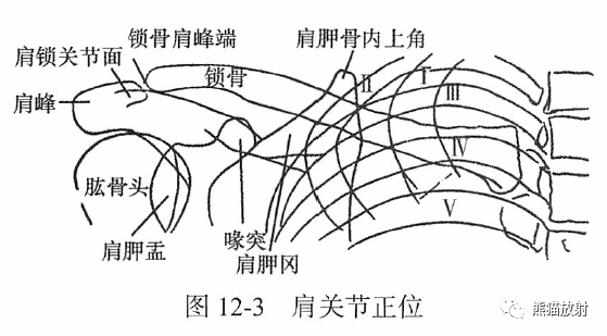 正常关节的x线解剖关节病变的常规影像学分析顺序