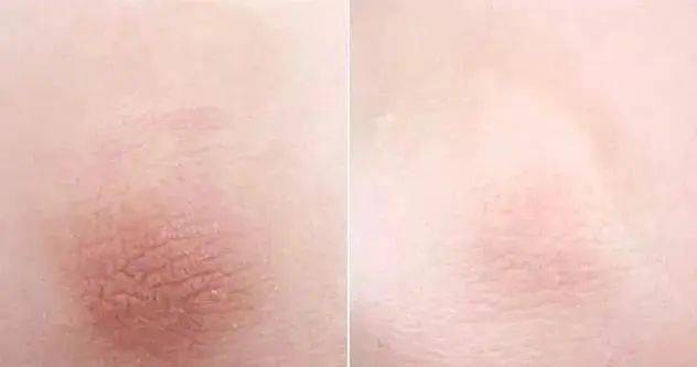 不知道|用1颗糖洗澡是什么体验？不洗都不知道身上这么脏，竟然还能扣出油脂粒！