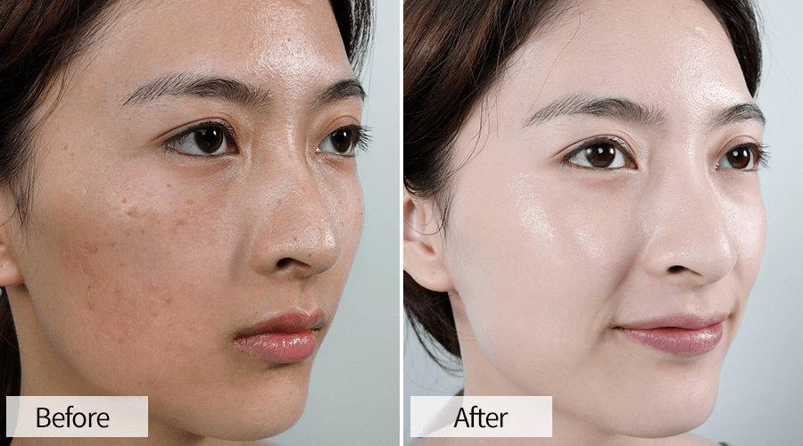 鼻血|“越南杨幂”太性感！15秒片段疯传，吸500万人围观：鼻血止不住……