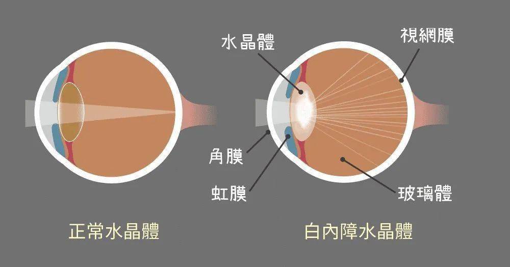 自由基是怎么让细胞衰老的 672bd94da4cf4af4b5e05cf171baf32e.jpeg