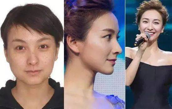 换季|吴昕、林允睡前都在用的懒人超爱保养品，一次性解决换季皮肤敏感、泛红、脱皮...