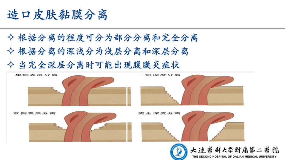 【ppt】泌尿造口全程管理