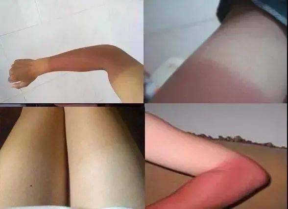 防晒霜|在剧里为了省钱大晒太阳的江疏影，生活中居然坐在车里打伞......