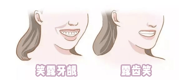 表情|郑爽，你该学学表情管理了！