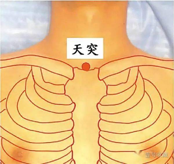 天突:仰靠坐位取穴,位于颈部,当前正中线上胸骨上窝中央.