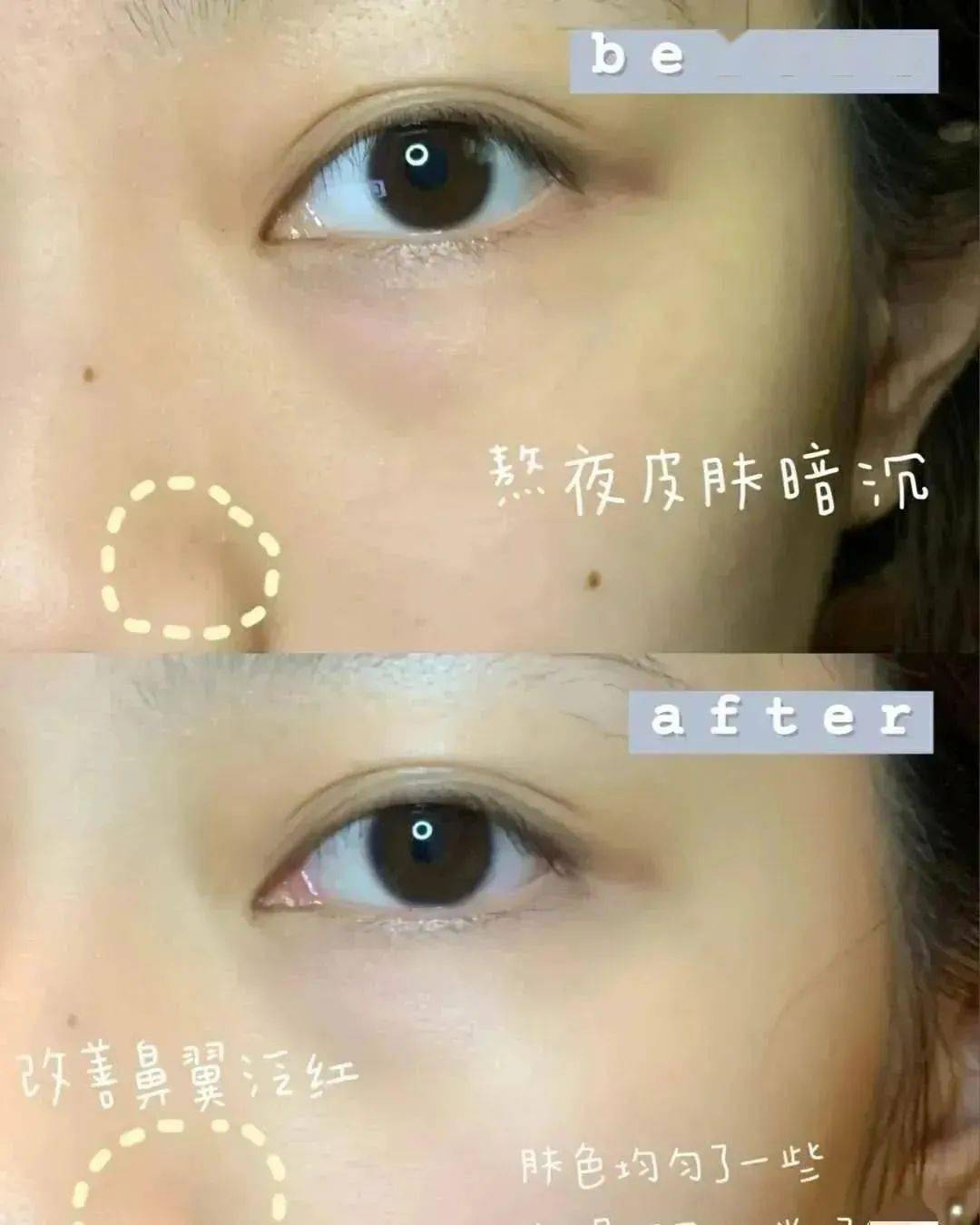 肌肤|40岁的年龄，18岁的脸，深扒“金喜善们”的冻龄术，竟然都是它！