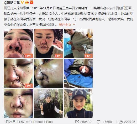 女子被67岁老人当街捅死：女性如何自我保护？