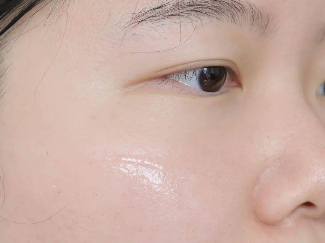 自救|皮肤敏感自救指南，找对原因才能轻松拯救！