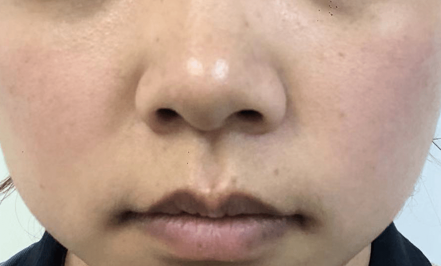 自救|皮肤敏感自救指南，找对原因才能轻松拯救！