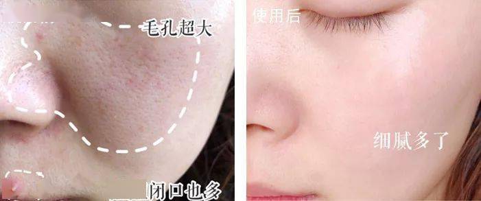 脸蛋|你的脸蛋“一键美颜”,除了滤镜还靠什么?