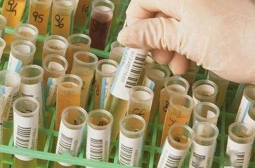 尿常规|一看就懂 | 尿常规检查全解读