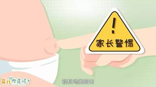 宝宝|是生病了吗？BB肚脐总会鼓出来