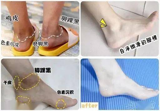 皮肤|白到发光的张雨绮性感冲出屏幕!这次成了“直女斩”