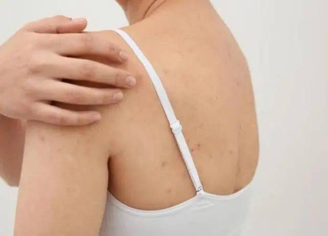 皮肤|白到发光的张雨绮性感冲出屏幕!这次成了“直女斩”