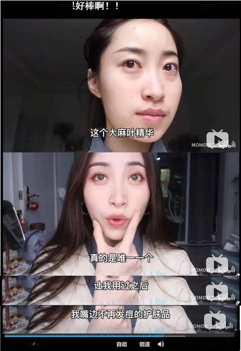 保养|张雨绮每月保养脸疑花70万，听了伊能静的金额……贫穷限制了我的想象