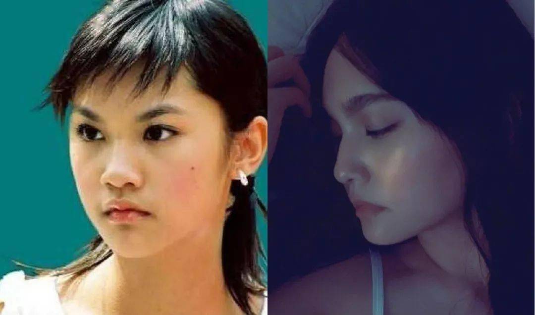 do|为什么杨丞琳do脸就能无痕保鲜20年？