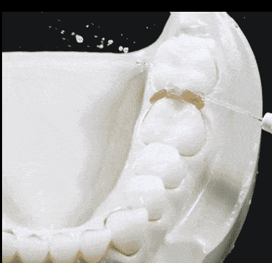 食物残渣|到底有多重要？你有一口好牙