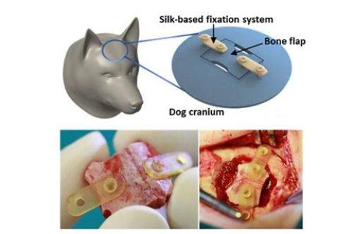 诊断|脑科学发展进入黄金时代，高精尖医疗器械市场巨大