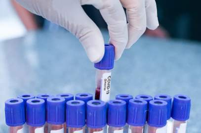 病例|美国大学秋季开学至今报告超过37000例新冠病例