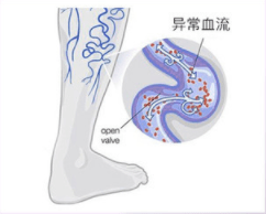 腿部|吴昕录制《乘风破浪的姐姐》都在用它,难怪万年小粗腿翻身成腿精!小腿细得像打了瘦腿针!