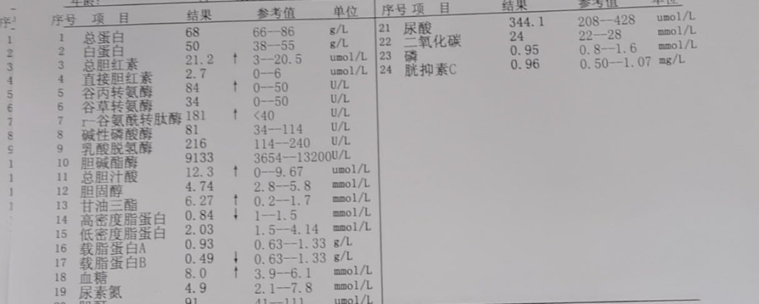 一招快速去高血脂——吉大一院输血科血细胞分离机开展治疗效果显著