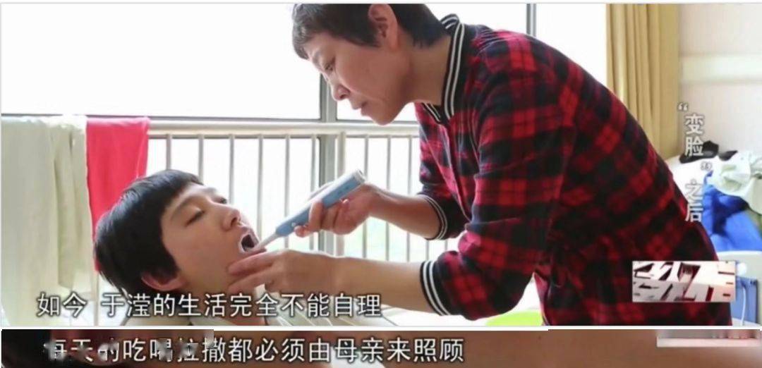 畸形|“我花100万，把女儿整成了残废”：畸形审美毒害下，有20万女孩正在消失！