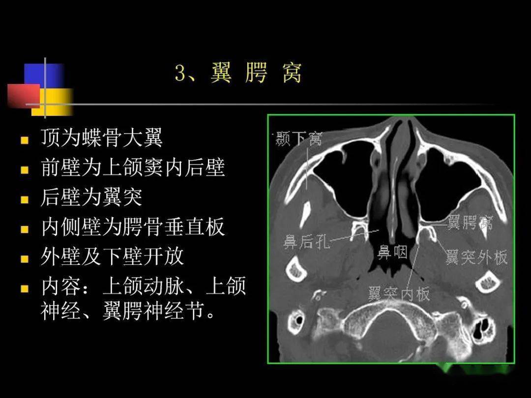 鼻咽部ct解剖