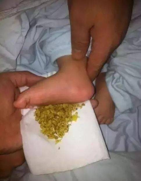 鼻腔|宝宝鼻塞不通气?只需一招轻松搞定!