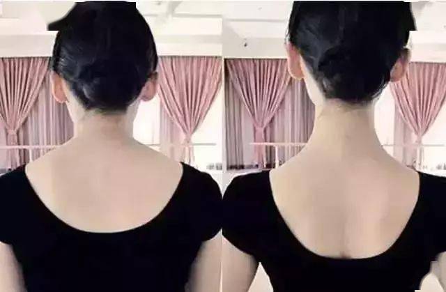 矫姿|被扒出来了！张雨绮“浪姐”全程穿它塑形！1s挺拔，让你气质好到爆