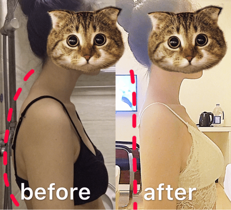 矫姿|被扒出来了！张雨绮“浪姐”全程穿它塑形！1s挺拔，让你气质好到爆